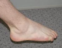 restoring vital energy to ankle, healing ankle