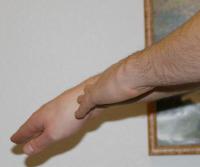 restoring vital energy to wrist, healing wrist